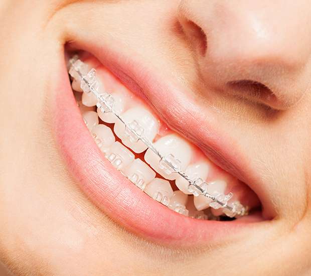 Highlands Ranch Invisible Orthodontics