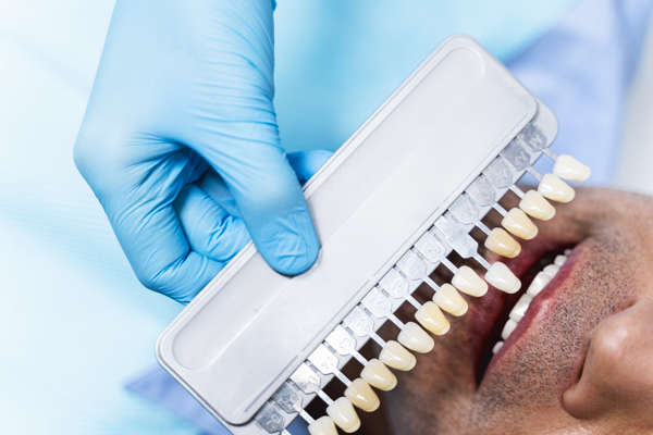 How A Cosmetic Dentist Improves The Appearance Of Your Smile