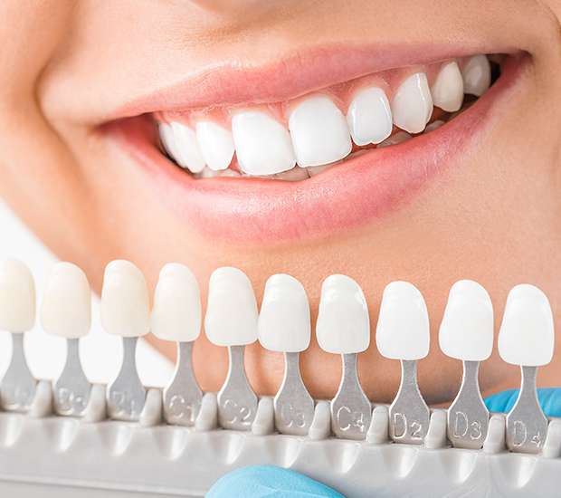 Highlands Ranch Cosmetic Dentist