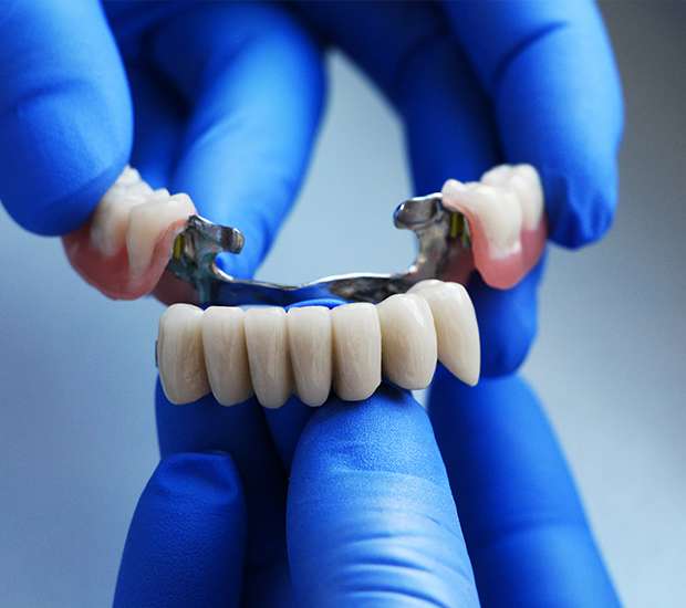 Highlands Ranch Dental Bridges