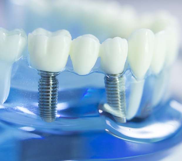 Highlands Ranch Dental Prosthetics