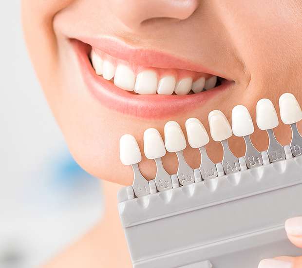 Highlands Ranch Veneers