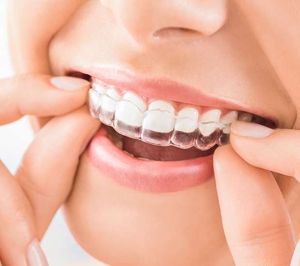 Highlands Ranch Does Invisalign® Really Work?