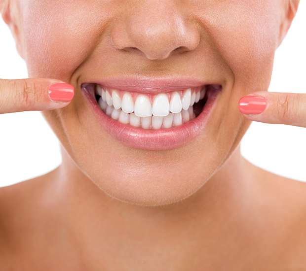 Highlands Ranch What Is Gum Contouring and Reshaping