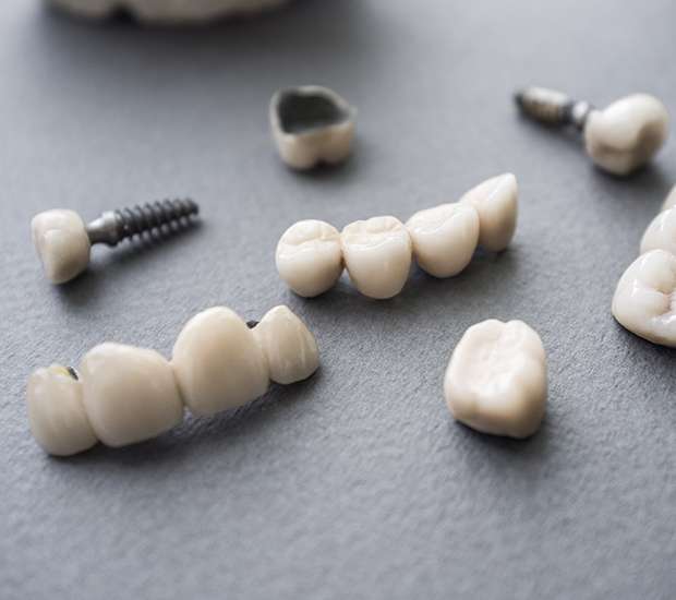 Highlands Ranch The Difference Between Dental Implants and Mini Dental Implants