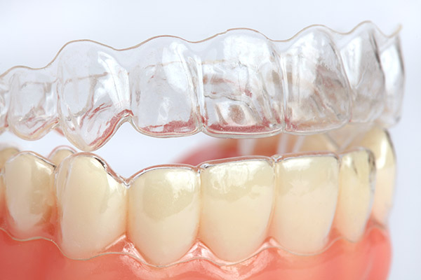The Truth About Invisalign And How It Can Straighten Your Teeth