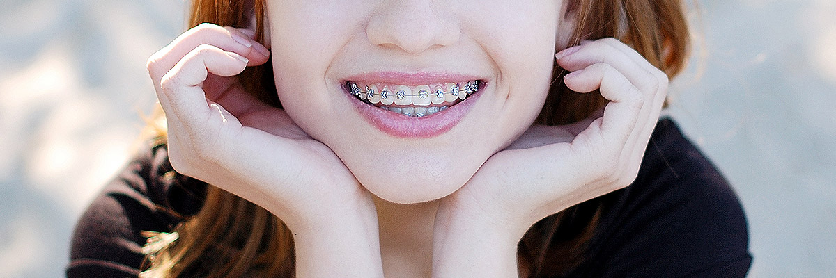 Highlands Ranch Orthodontics