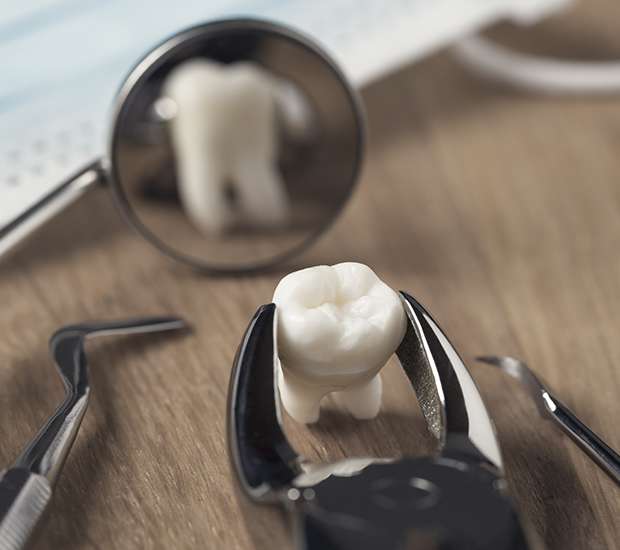 Highlands Ranch When Is a Tooth Extraction Necessary